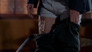 episode 2x13 Skin Deep - Maladie d'amour