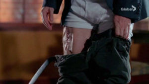 episode 2x13 Skin Deep - Maladie d'amour