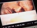 Preview Tournage L'Oréal (1)